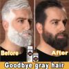 Super Fast 5x Hair Growth Oil Fenugreek Anti-Hair Loss Oil Rosemary Hair Regrowth Chebe Batana Butter  Amla Oils For Men Women