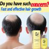 Ouhoe 30ml Collagen B7 Vitamin Hair Care Essential Oil Anti Hair Loss Moisture Repair Baldness Scalp Care Hair Growth Serum Oil