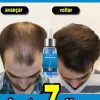 Fast Hair Growth Oil Africa Crazy Traction Alopecia batana Hair Mask Anti Hair Break Hair Strengthener Hair Loss Treatment Spray